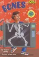 Bones (1999)